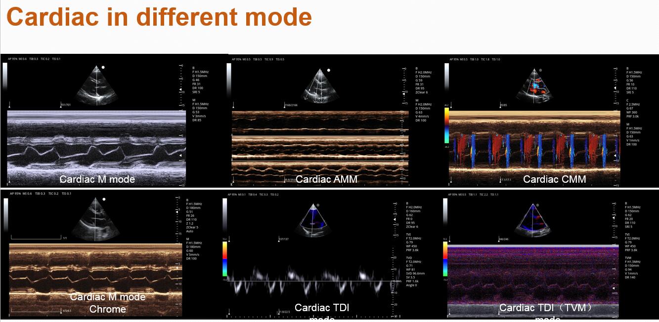 color doppler 4 color doppler 4