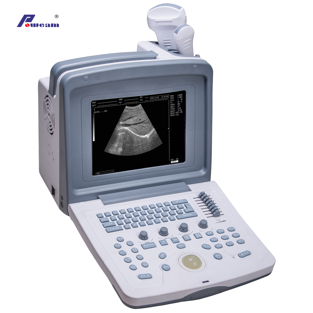 Medical Portable Ultrasound Scanner 