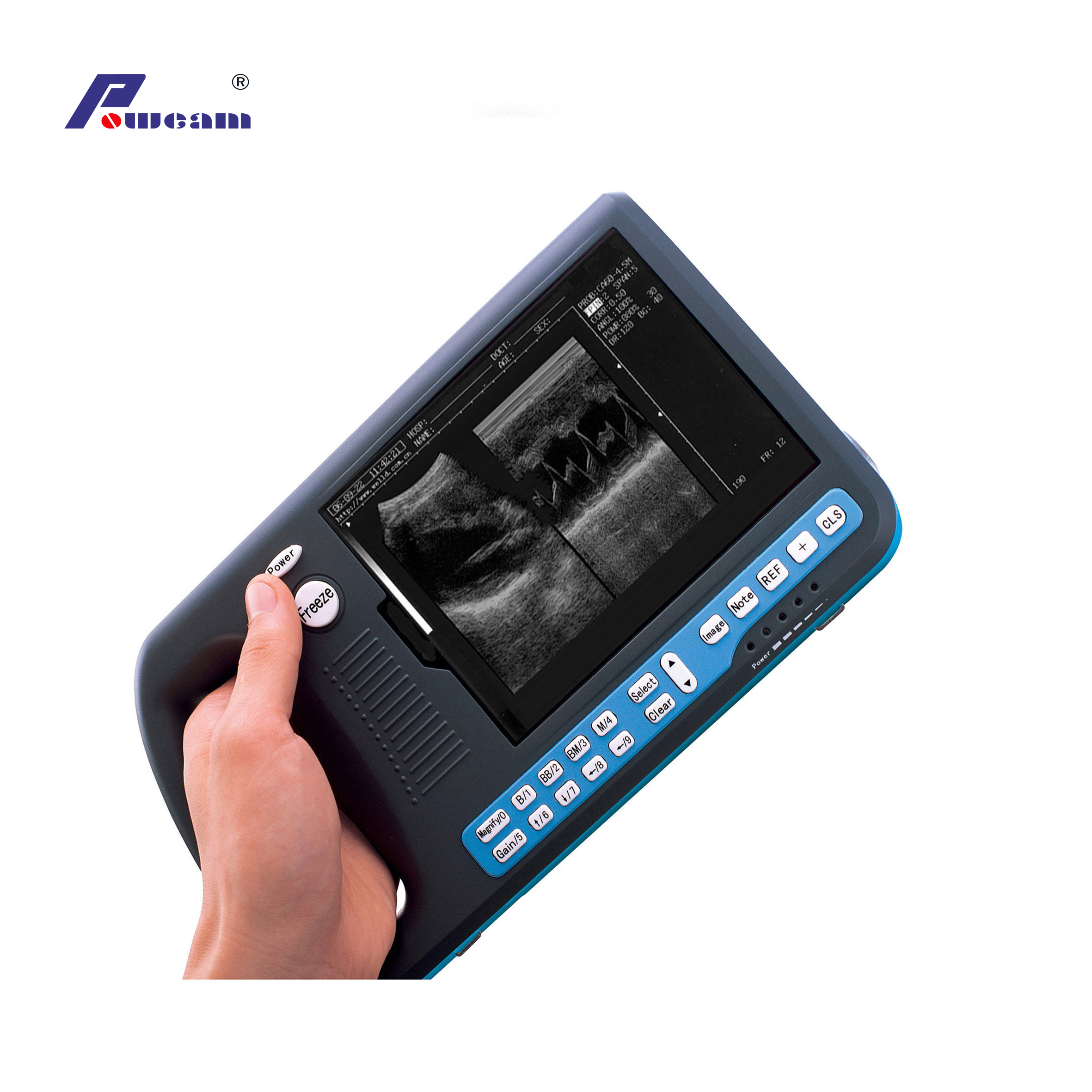 Hosipital Digital Palmtop Ultrasound Scanner 
