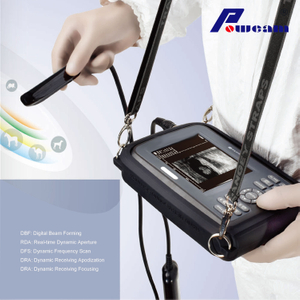 Hospital Handheld Ultrasound Scanner (whyb4000)