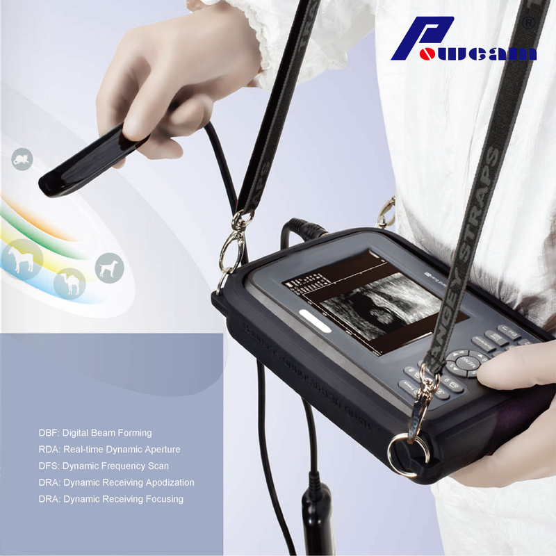 Hospital Handheld Ultrasound Scanner (whyb4000) from China manufacturer ...