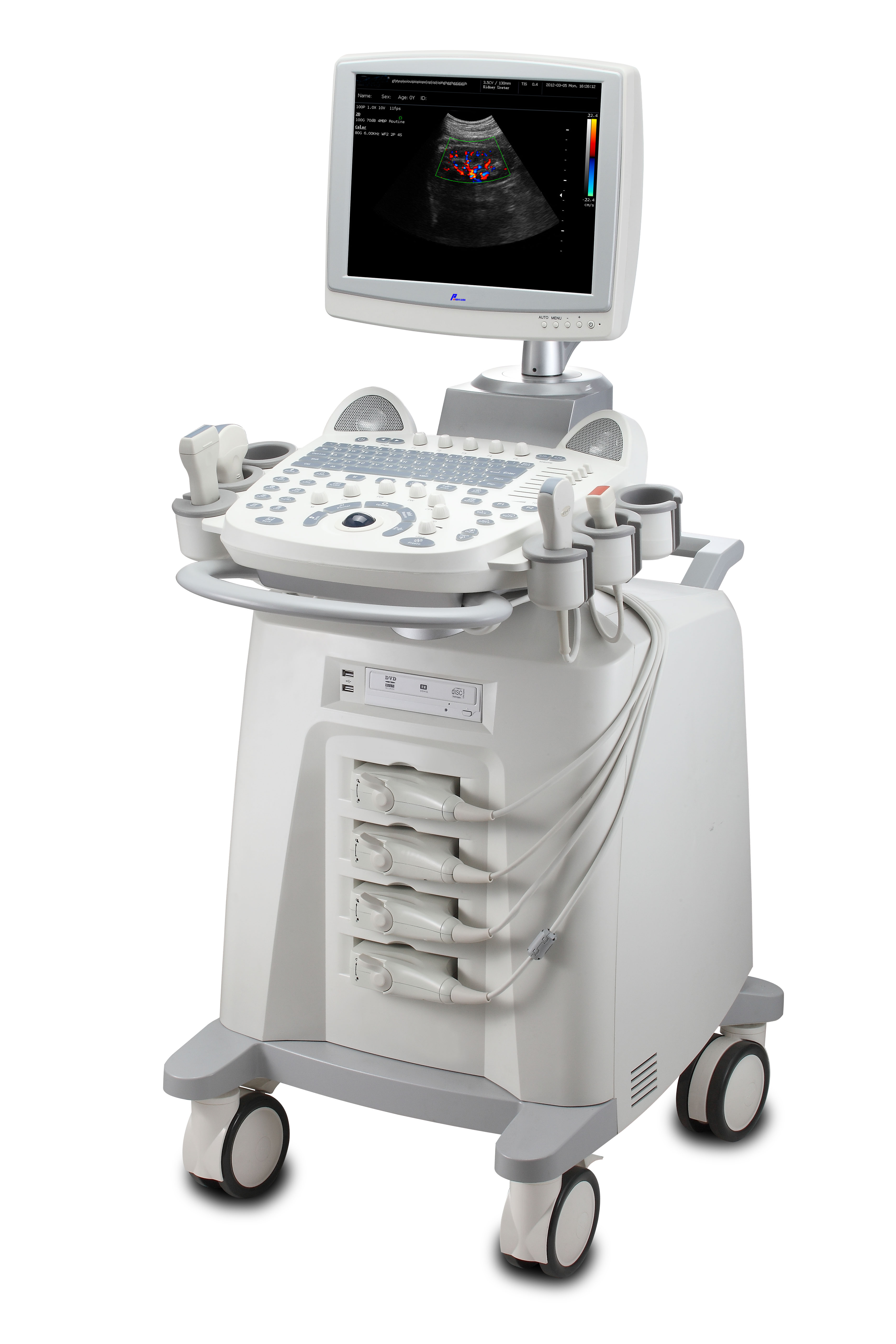 Hospital Medical Portable And Mobile Sonoscape 4D Color Doppler