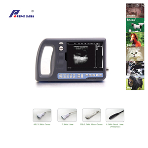 Digital Palmtop Ultrasound Scanner (WHYB3000)