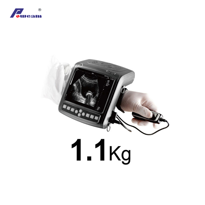 Wrist Digital Ultrasound Scanner (WHYB2000 Plus)