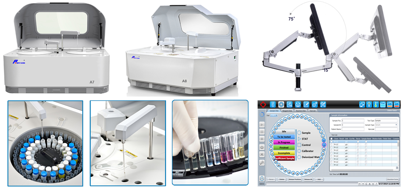 What is automated chemistry analyzer? Poweam Medical