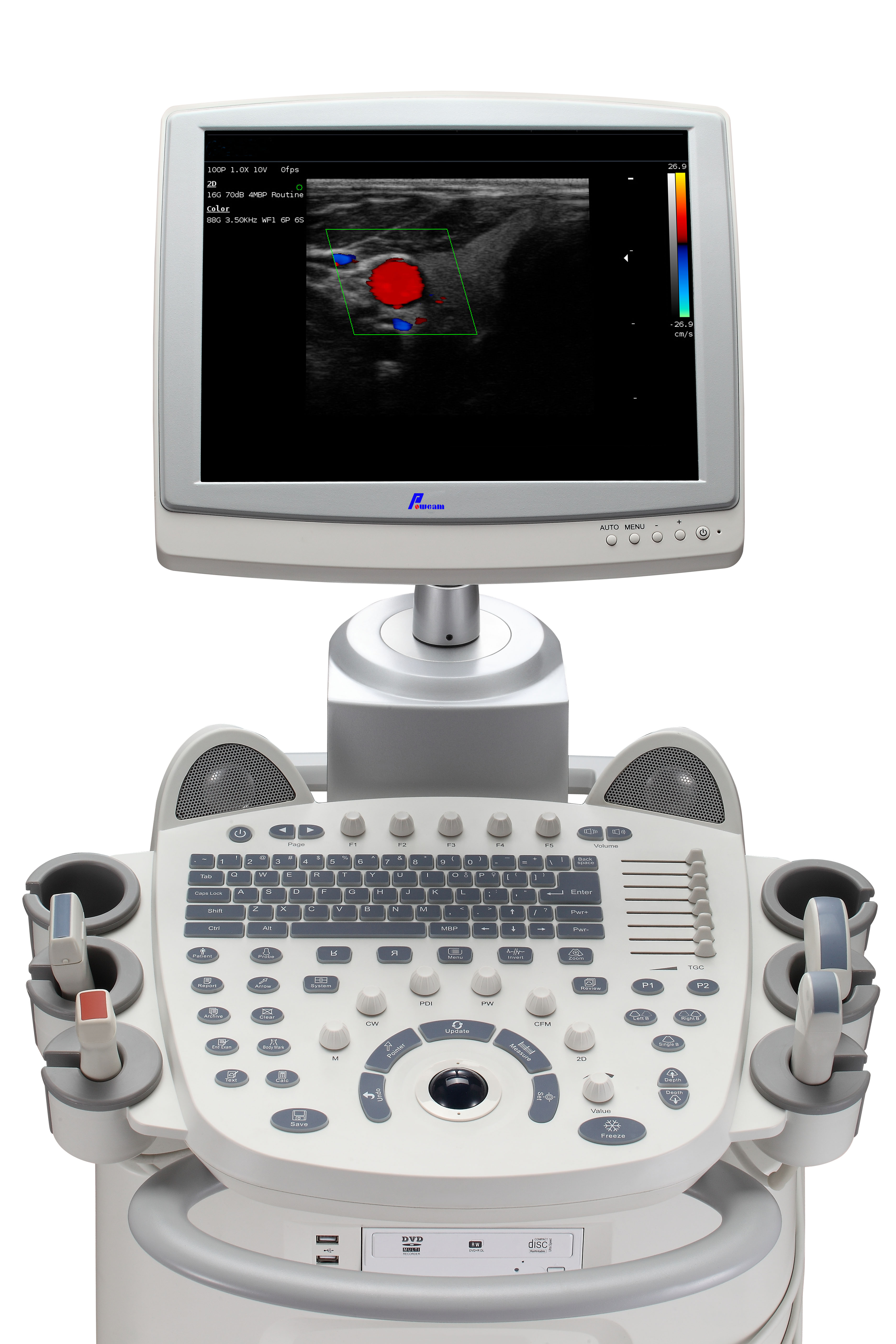 Hospital Medical Portable And Mobile Sonoscape 4D Color Doppler