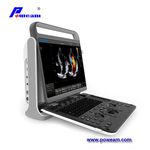 Chison Ebit60 Portable Color Doppler Ultrasound Scanner for Cardiac 