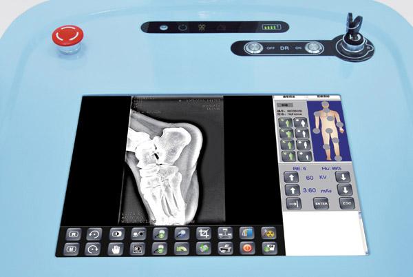 DR200 High Frequency Mobile Digital Radiography System