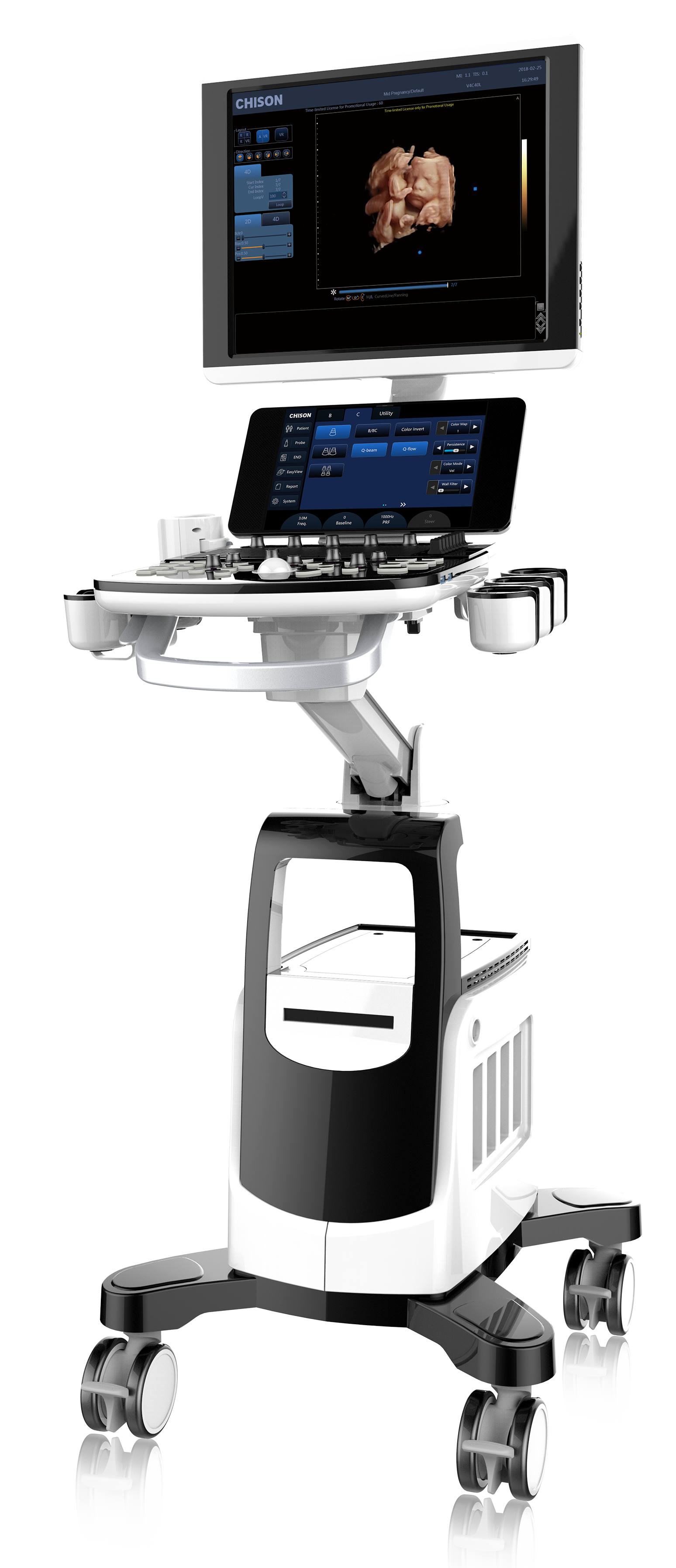 Toshiba Mindray Chison Color Doppler Ultrasound Machine 