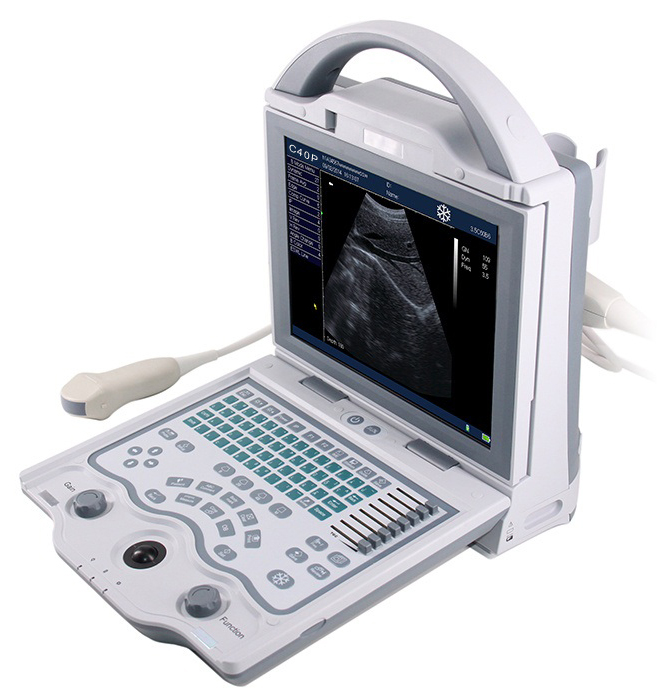 Low Cost Siemens Sonoscape Chison Laptop Portable Ultrasound Scanner