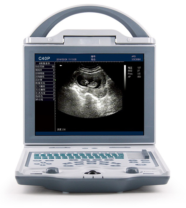 Low Cost Siemens Sonoscape Chison Laptop Portable Ultrasound Scanner