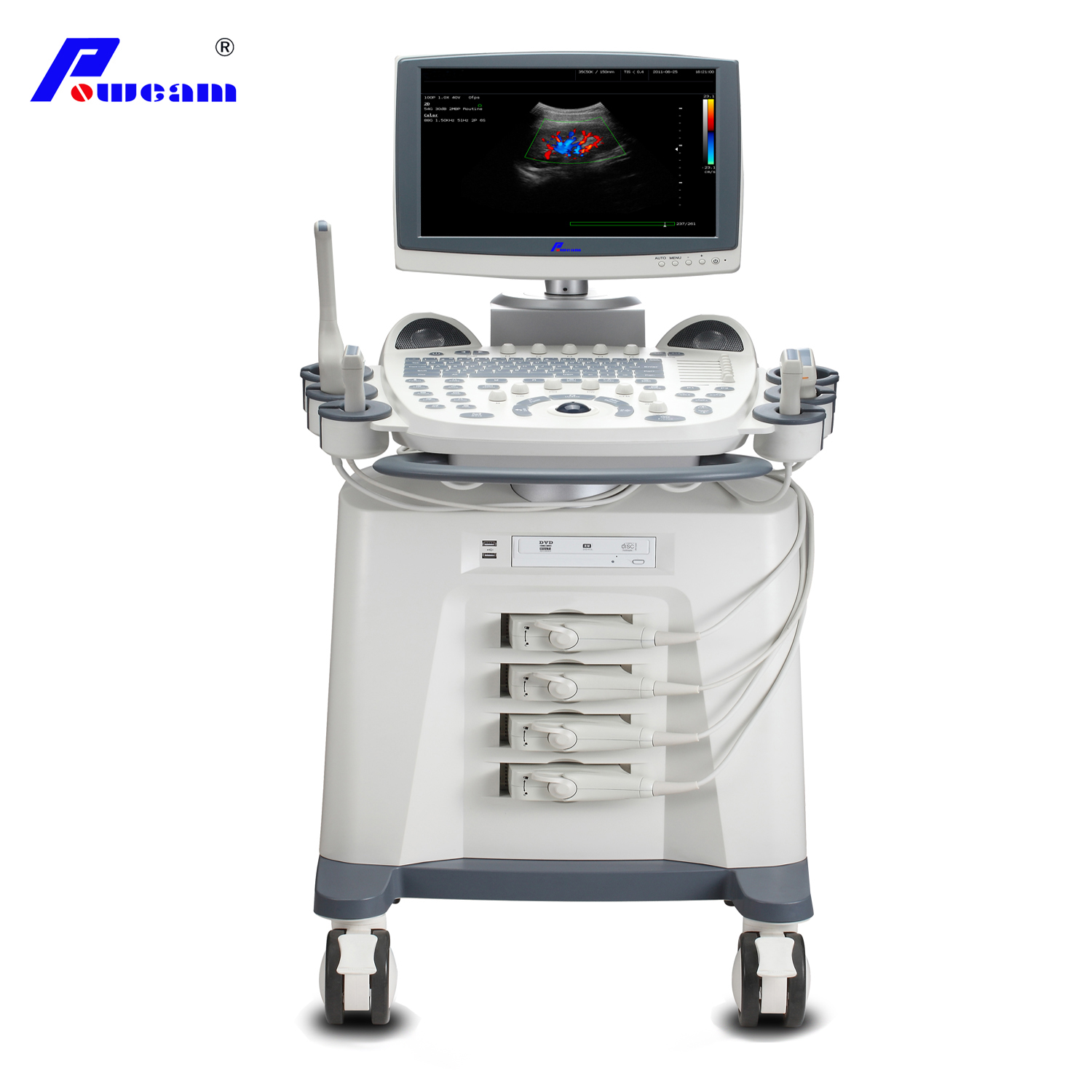 Ultrasonic Diagnostic Color Doppler Ultrasound Scanner (D70)