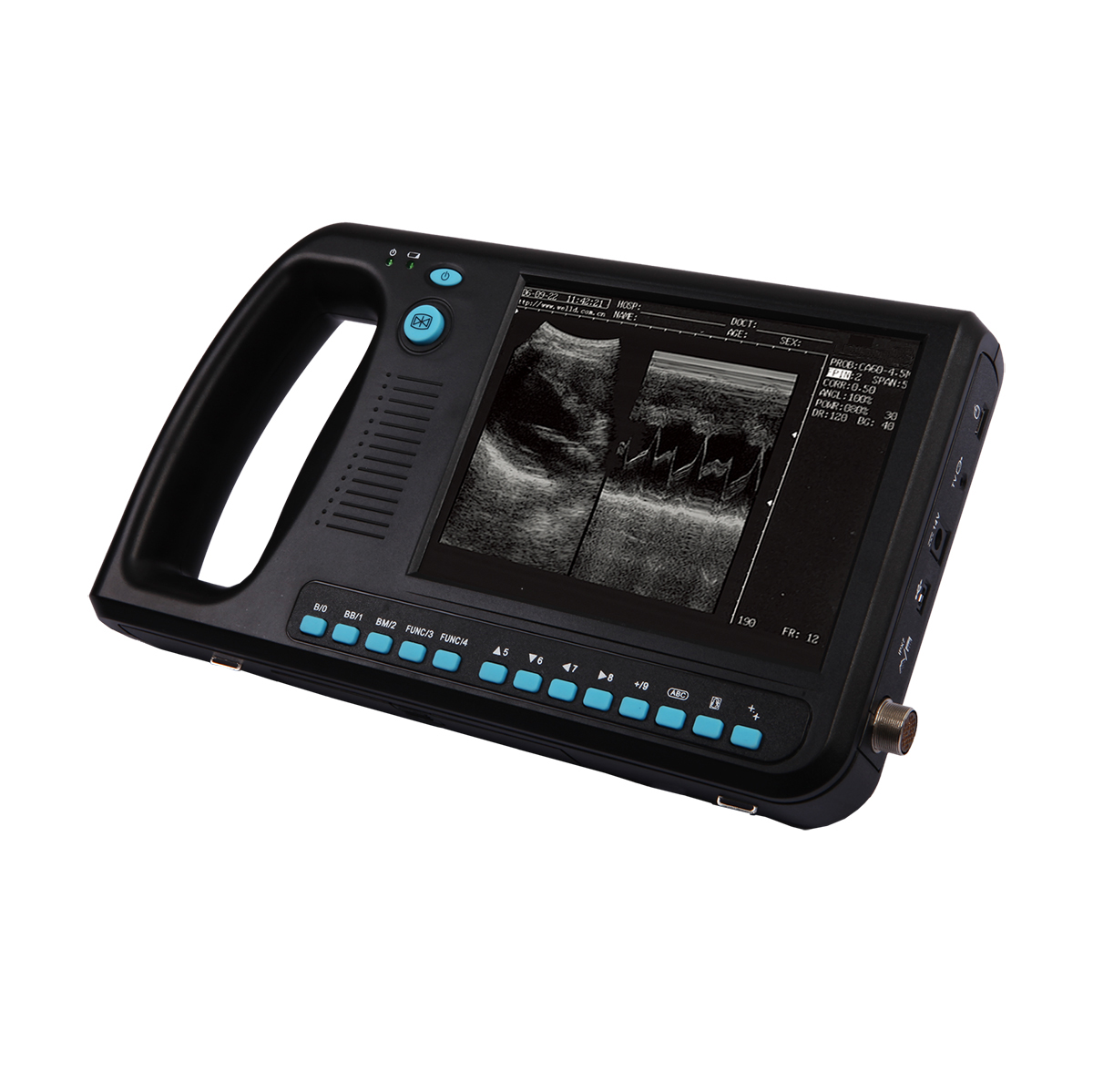 Medical Digital Palm Smart Cow Veterinary Ultrasound Scanner