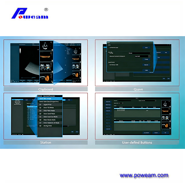 High Performance Color Doppler Diagnosis System for Clinical Imaging