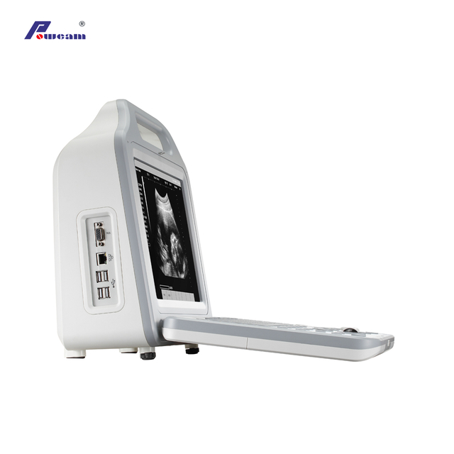 Digital Laptop Portable Ultrasound Scanner with LCD Display (WHYC50P)