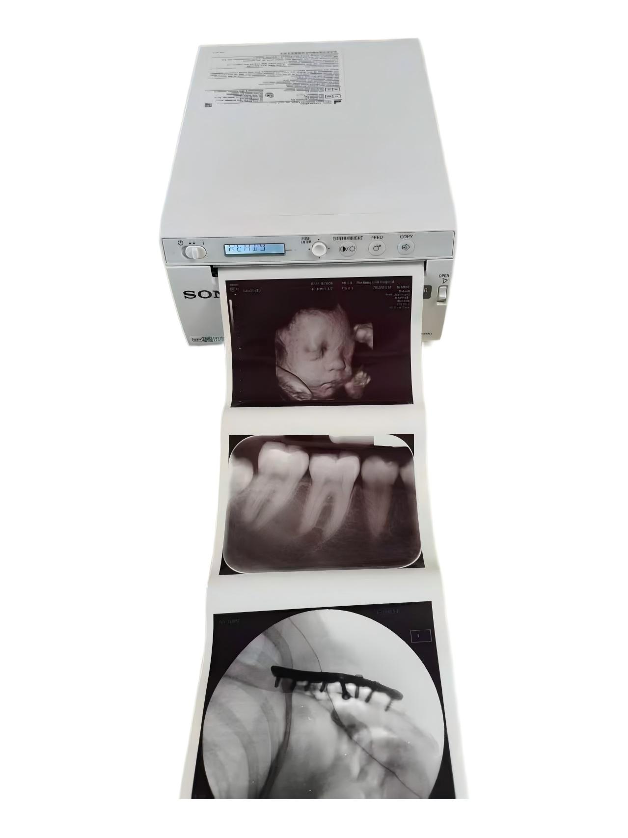 up-X899MD Ultrasound Image Digital Black and White Hybrid Thermal Graphic Printer