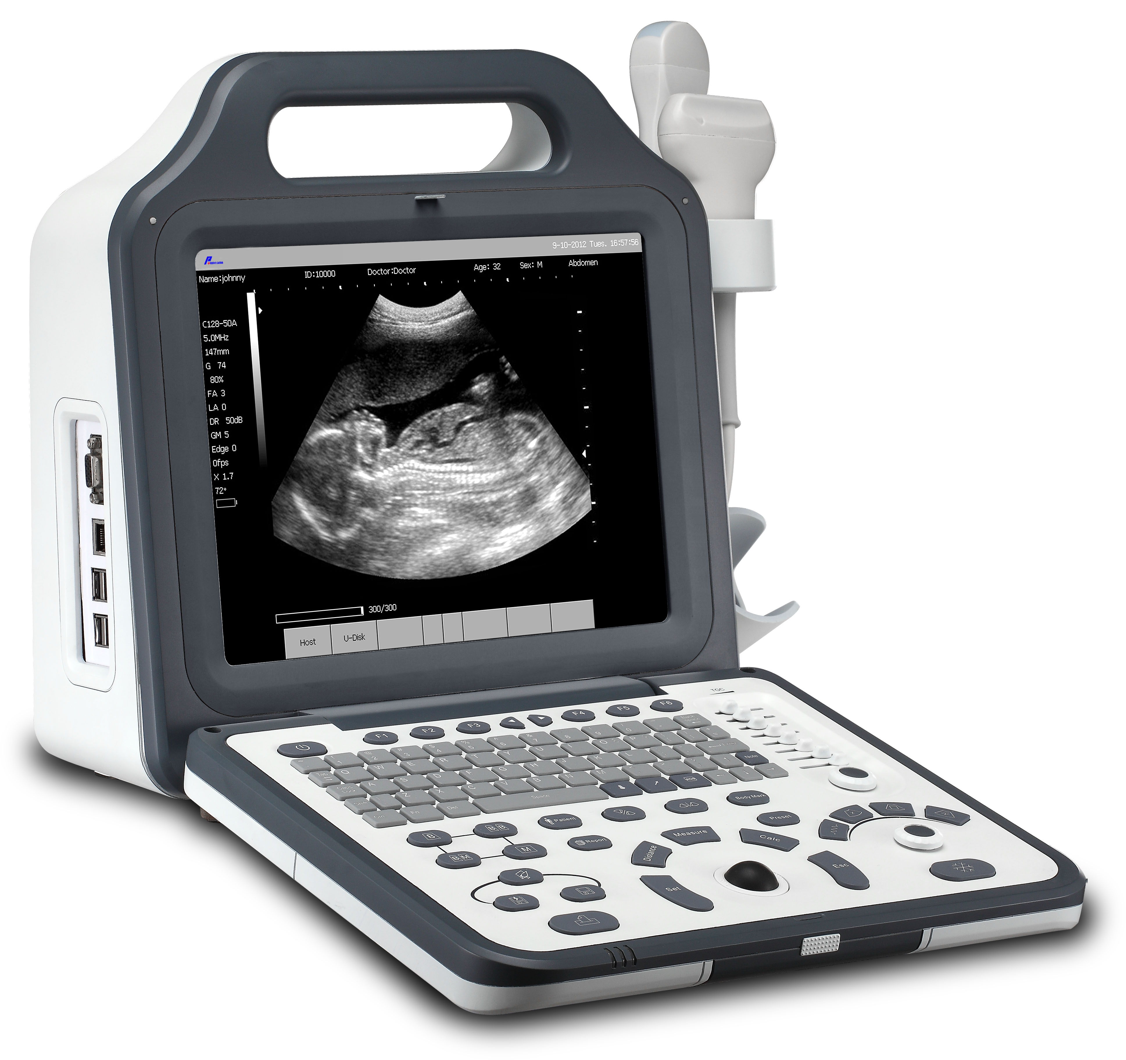 LCD Display Digital Laptop Ultrasound Scanner (WHYC60P)