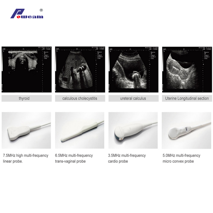 Wrist Digital Ultrasound Scanner (WHYB2000 Plus)