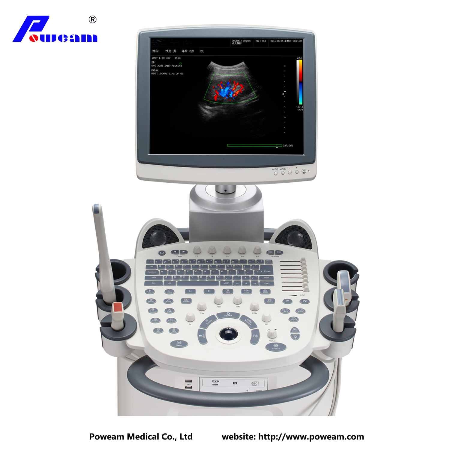 Ultrasonic Diagnostic Color Doppler Ultrasound Scanner (D70)