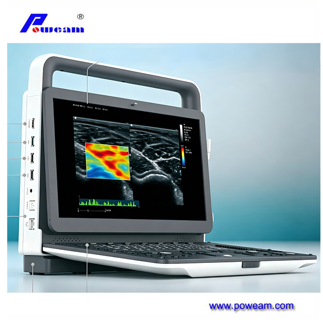 High Performance Color Doppler Diagnosis System for Clinical Imaging