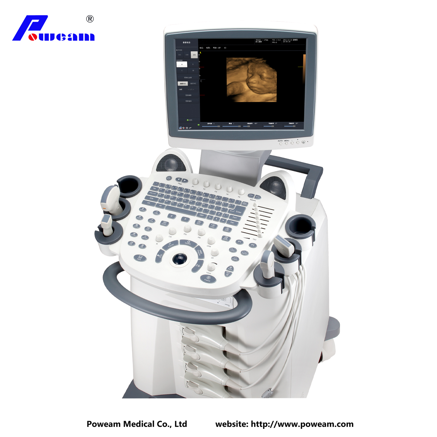 Ultrasonic Diagnostic Color Doppler Ultrasound Scanner (D70)