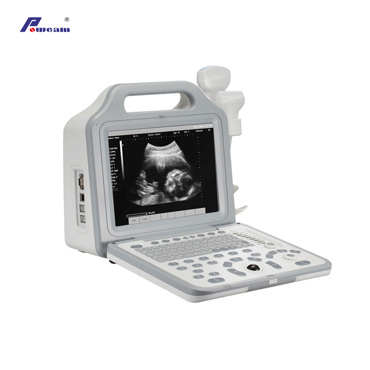  Digital Laptop Portable Ultrasound Scanner with LCD Display 