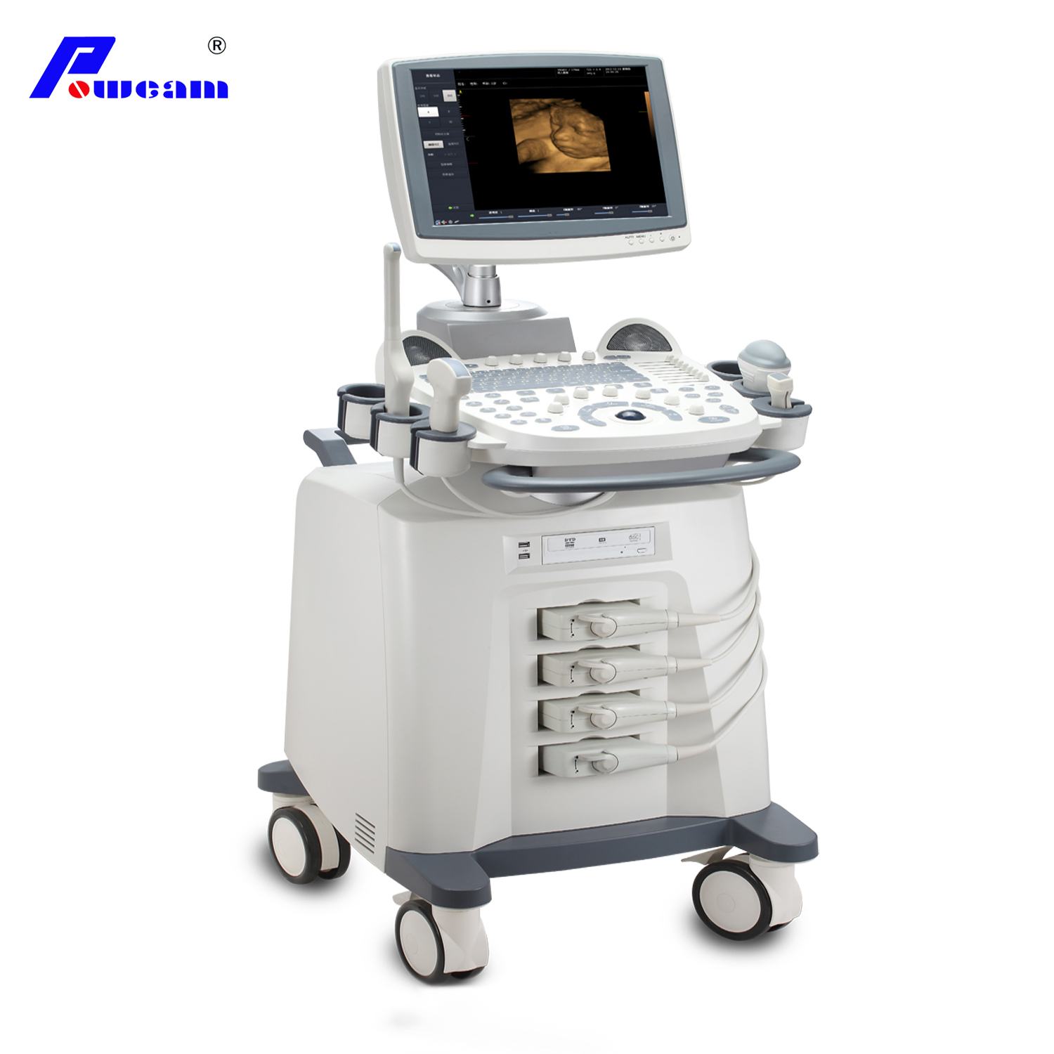 Ultrasonic Diagnostic Color Doppler Ultrasound Scanner (D70)