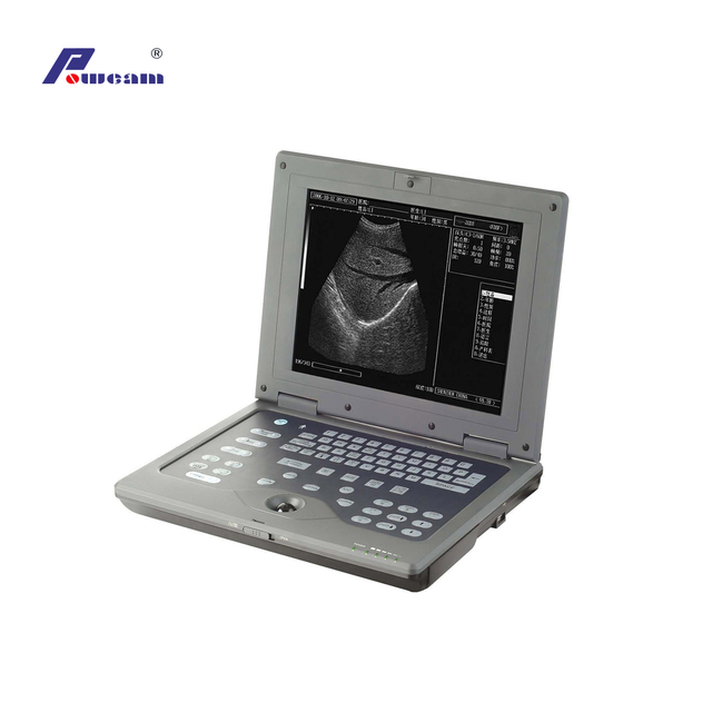Laptop Ultrasound Scanner