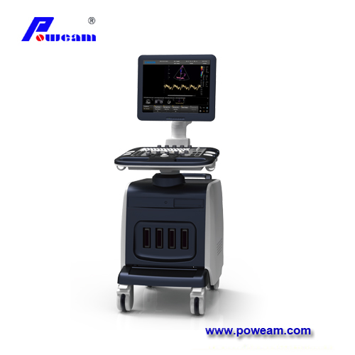 Chison I8 Color Doppler Ultrasound